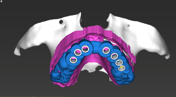 CoDiagnostix® Software - Producer License by Dental Wings