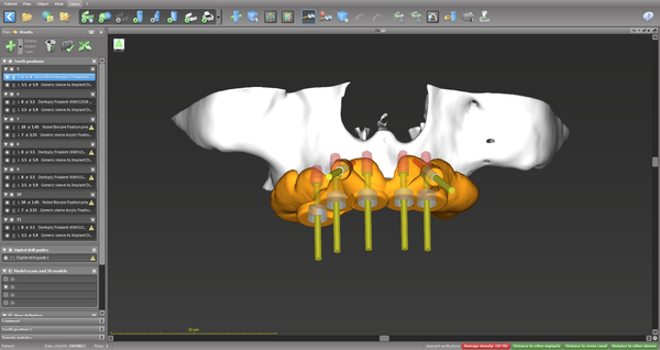 CoDiagnostix® Software - Client License by Dental Wings