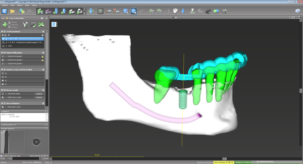 CoDiagnostix® Software - Client License by Dental Wings