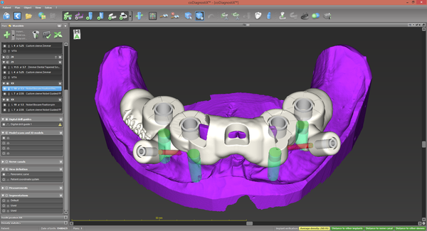 CoDiagnostix® Software - Client License by Dental Wings