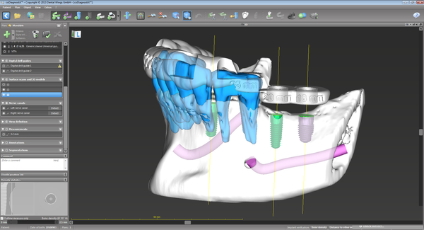 CoDiagnostix® Software - Client License by Dental Wings