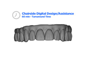 3DDX Full Arch Temporary Prosthesis Design with 1-Hour Turnaround Time