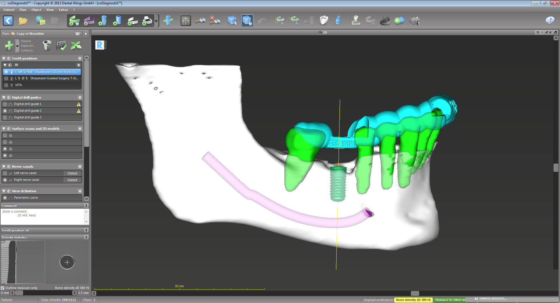 Ddx Software CoDiagnostix® Software - Client License by Dental Wings – 3DDX Online Shop